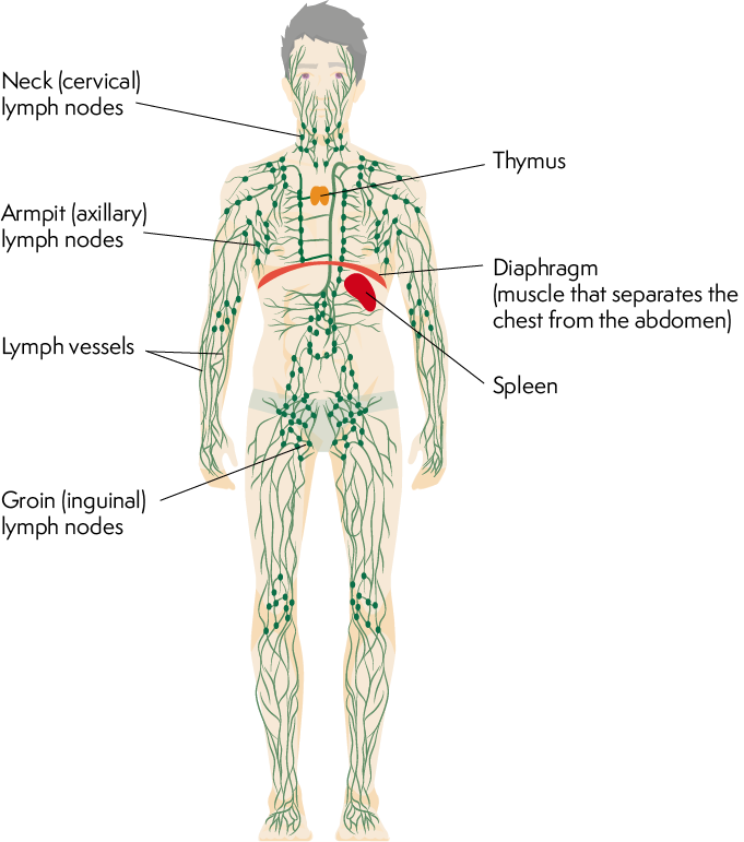 lymphoma-action-splenic-marginal-zone-lymphoma